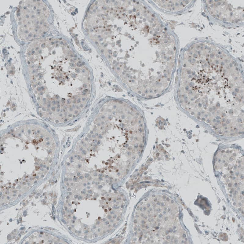 Immunohistochemistry-Paraffin FBF1 Antibody - BSA Free