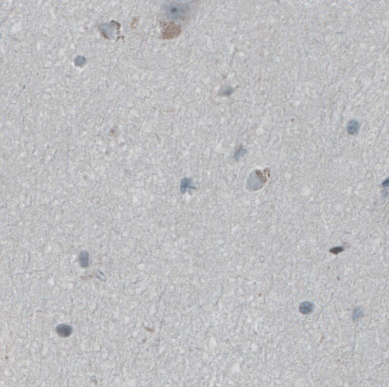 Staining of human cerebral cortex shows no positivity in neurons as expected.