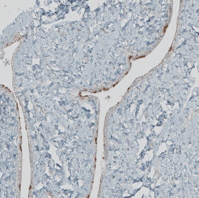 Staining of human fallopian tube shows weak membranous positivity in glandular cells.