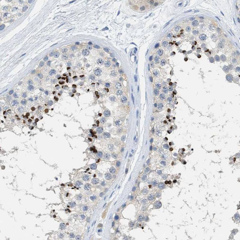 Immunohistochemistry-Paraffin EQTN Antibody - BSA Free