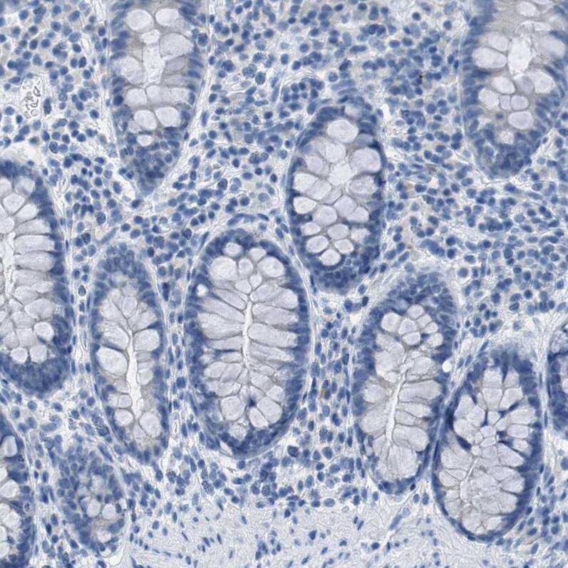 Immunohistochemistry-Paraffin EQTN Antibody - BSA Free