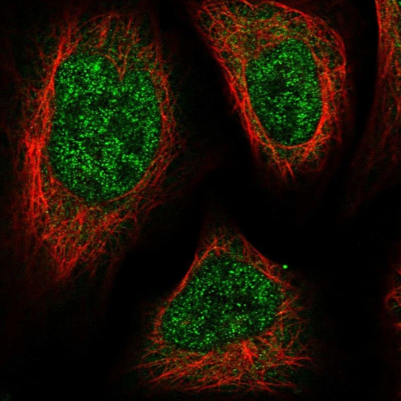 Staining of human cell line U-2 OS shows localization to nucleoplasm & cytosol.