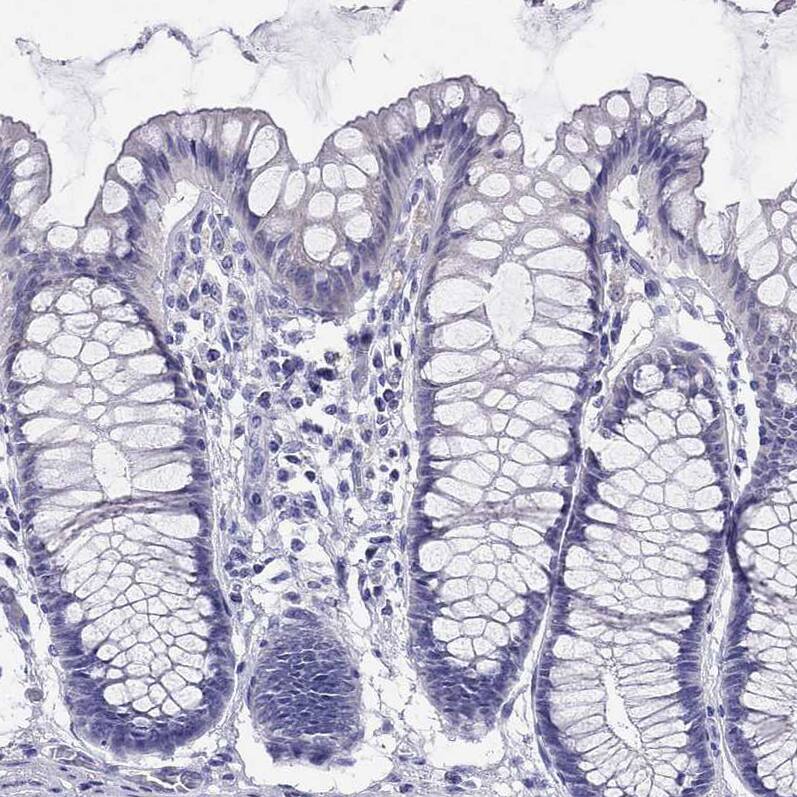 Staining of human colon shows no positivity in glandular cells as expected.