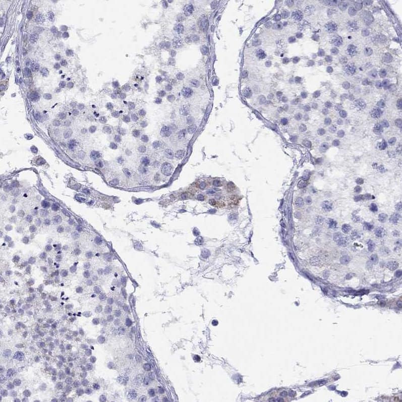 Staining of human testis shows weak cytoplasmic positivity in Leydig cells.