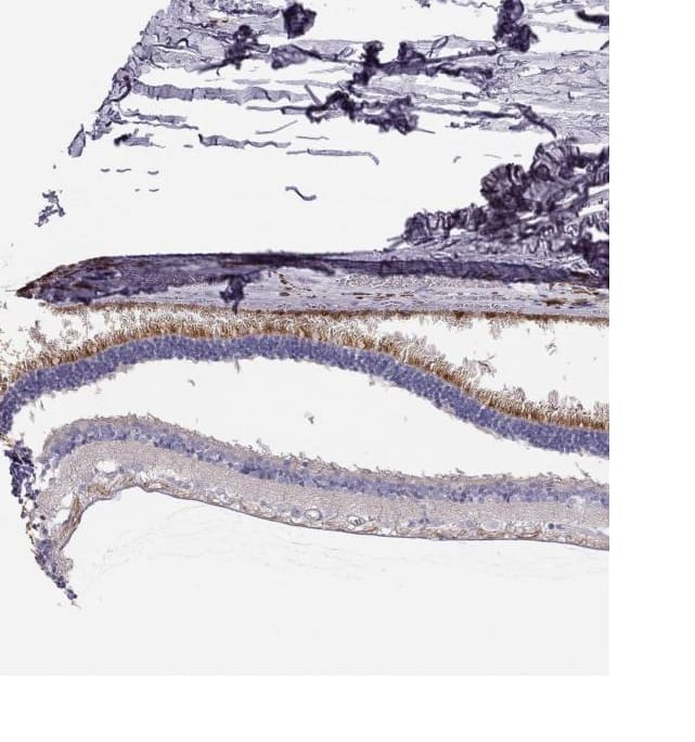 Staining of human eye, retina shows strong cytoplasmic positivity in photoreceptor cells.
