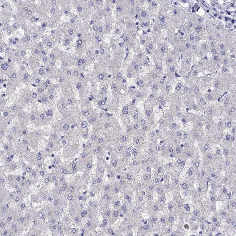 Staining of human liver shows no positivity in hepatocytes as expected.