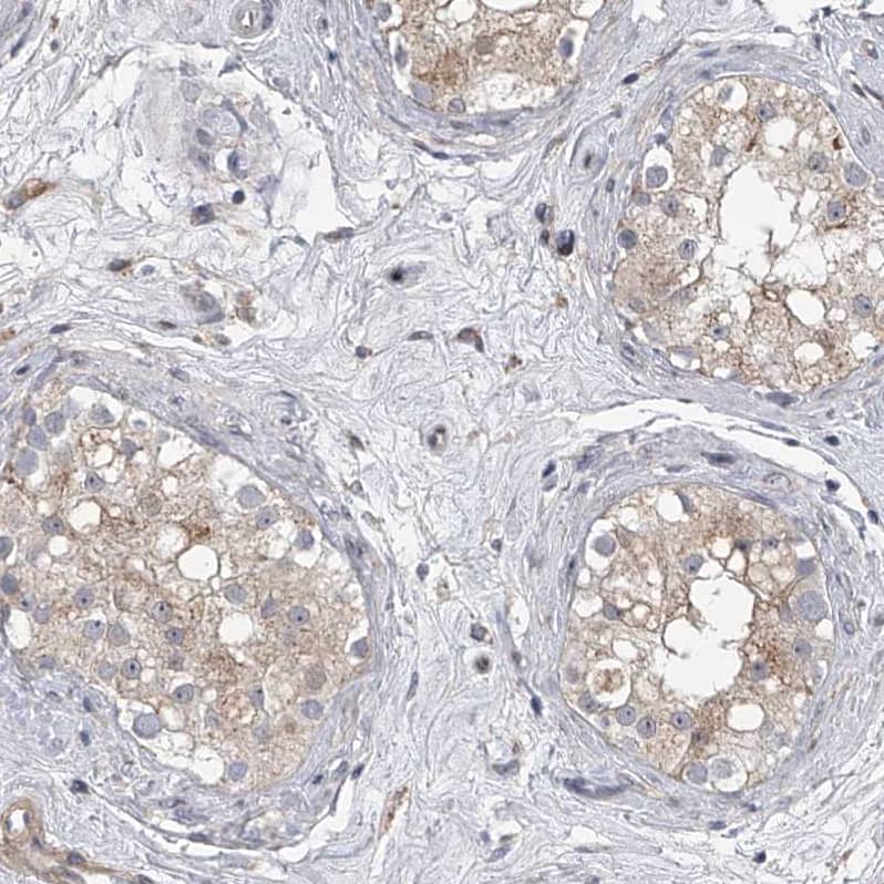 Immunohistochemistry HEATR6 Antibody - BSA Free