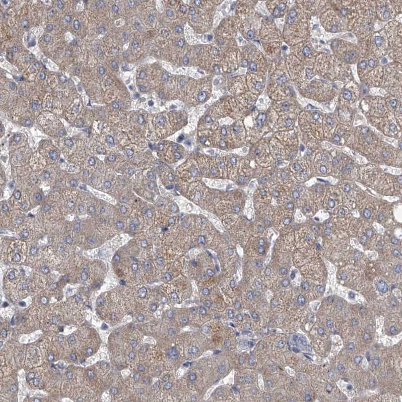 Immunohistochemistry HEATR6 Antibody - BSA Free