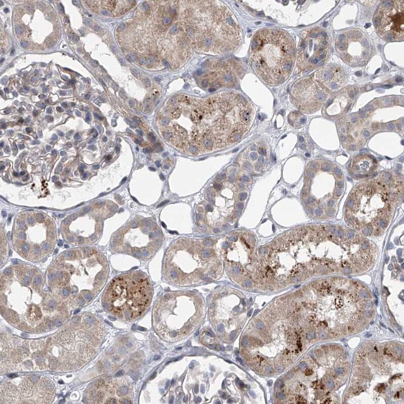 Immunohistochemistry HEATR6 Antibody - BSA Free