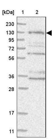 Western Blot HEATR6 Antibody - BSA Free