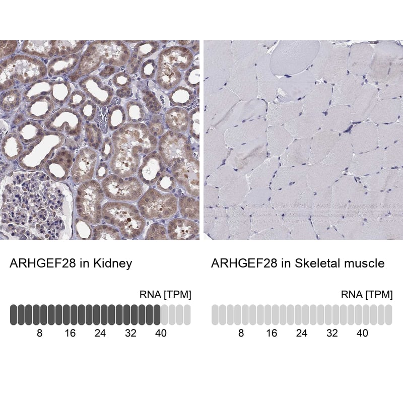 <b>Orthogonal Strategies Validation. </b>Analysis in human kidney and skeletal muscle tissues using Anti-ARHGEF28 antibody. Corresponding ARHGEF28 RNA-seq data are presented for the same tissues.