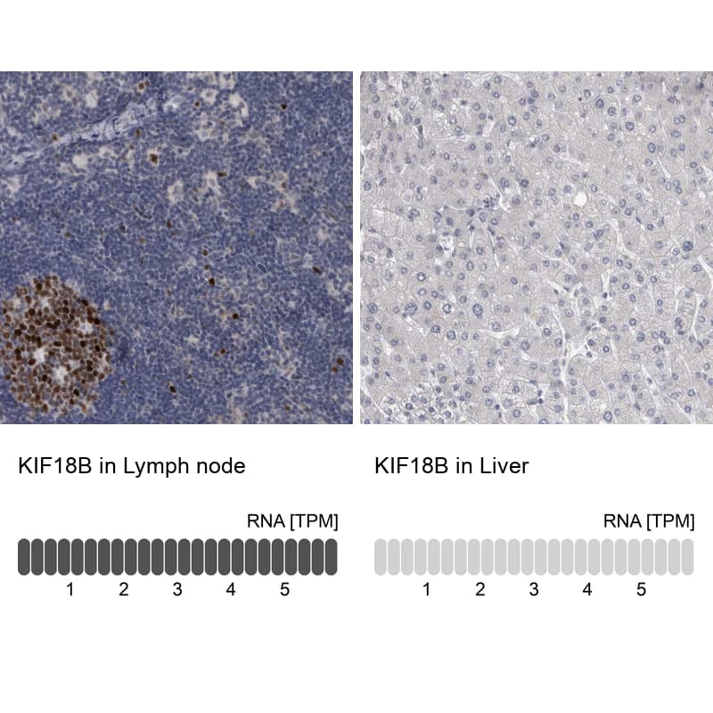 <b>Orthogonal Strategies Validation. </b>Analysis in human lymph node and liver tissues using NBP1-90882 antibody. Corresponding KIF18B RNA-seq data are presented for the same tissues.
