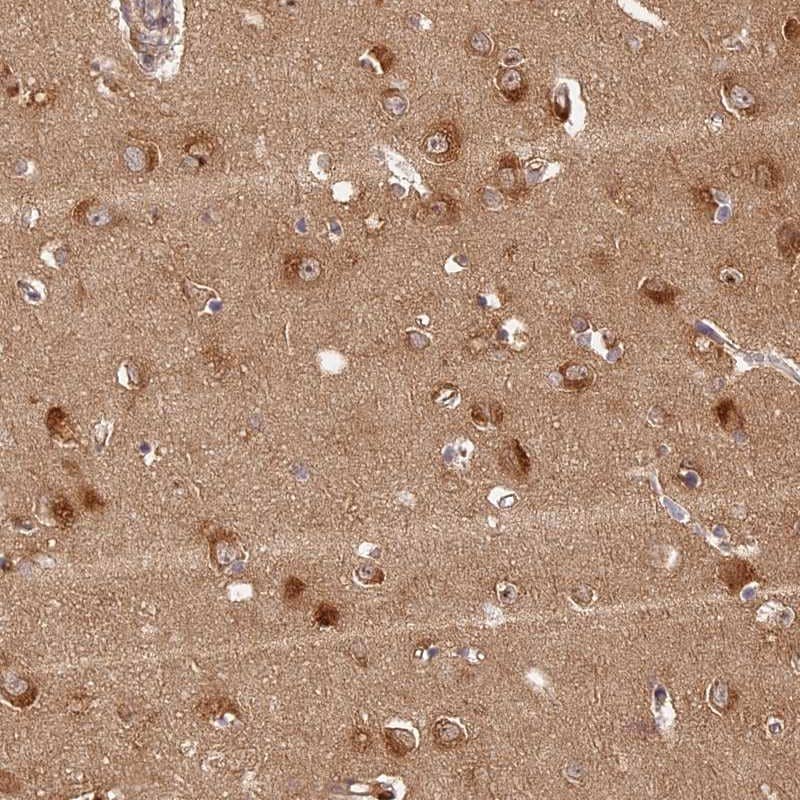 Immunohistochemistry-Paraffin LRRC68 Antibody - BSA Free