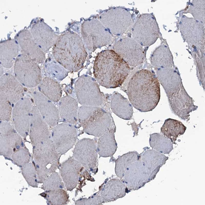 Staining of human skeletal muscle shows weak membranous-cytoplasmic positivity in myocytes.