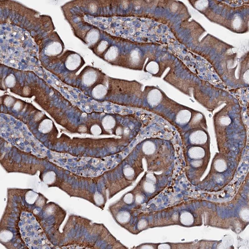 Staining of human small intestine shows strong membranous-cytoplasmic positivity in glandular cells.