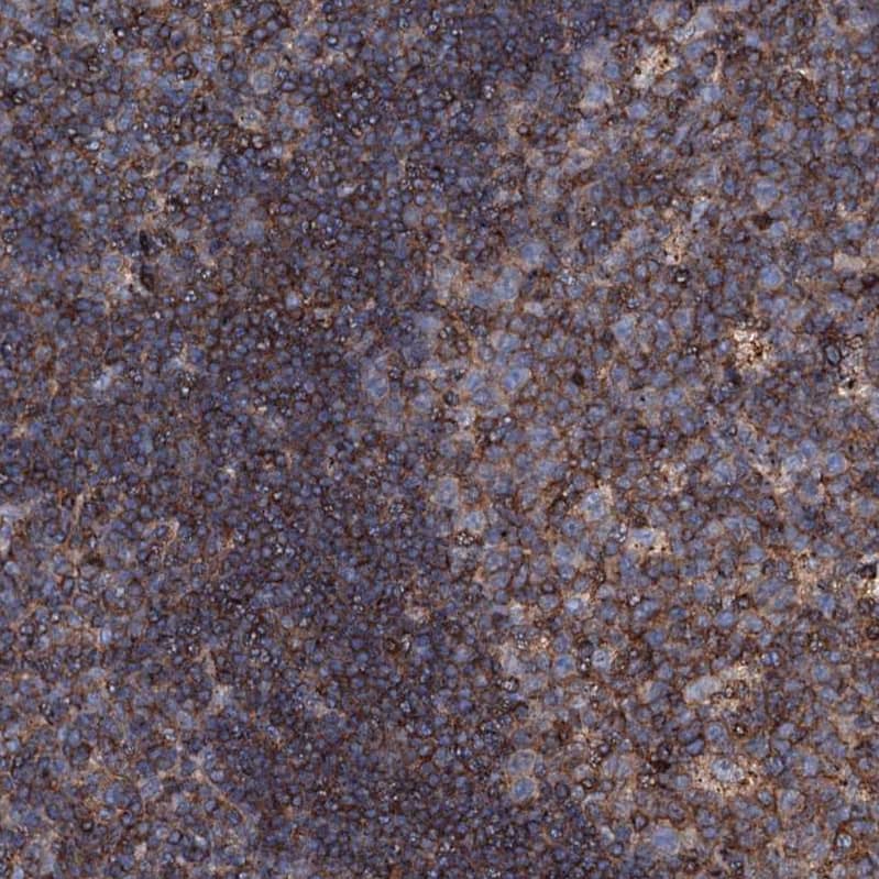 Staining of human tonsil shows strong membranous-cytoplasmic positivity in non-germinal center cells and germinal center cells.
