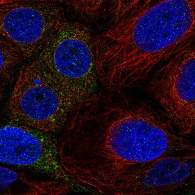 Staining of human cell line CACO-2 shows localization to cytosol.