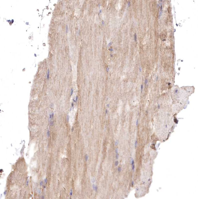 Staining of human skeletal muscle shows weak cytoplasmic positivity in myocytes.