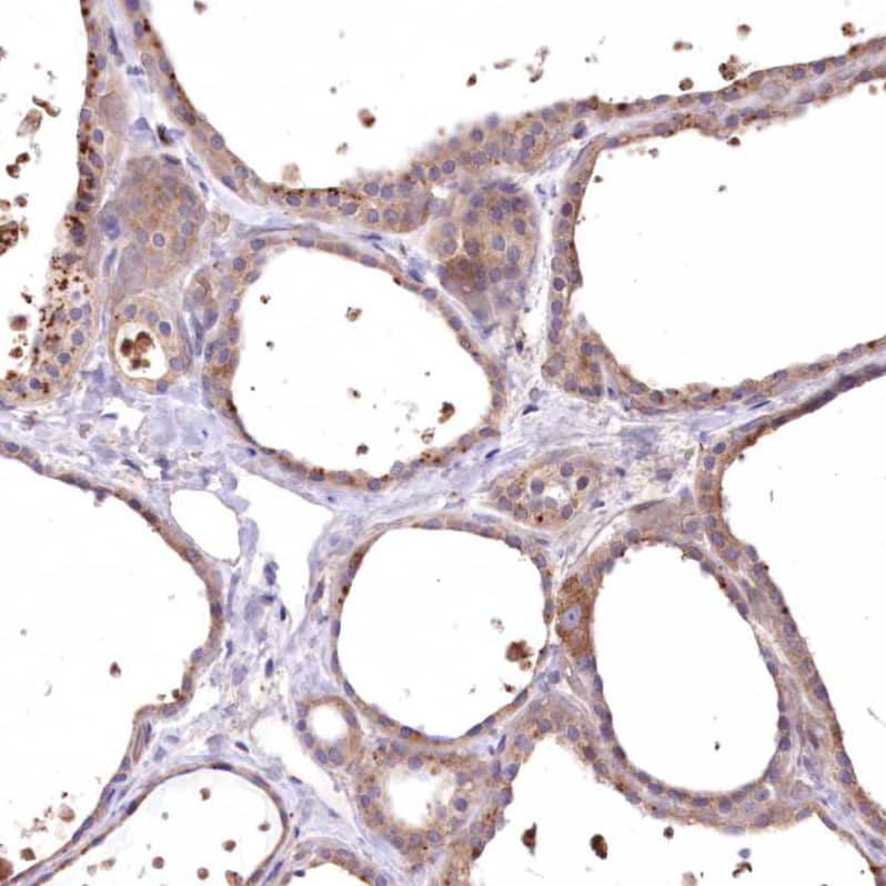 Staining of human thyroid gland shows moderate cytoplasmic positivity in glandular cells.