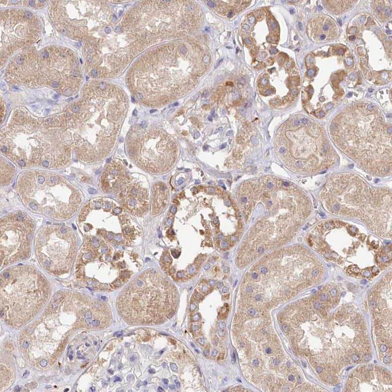 Staining of human kidney shows moderate cytoplasmic positivity in cells in tubules.