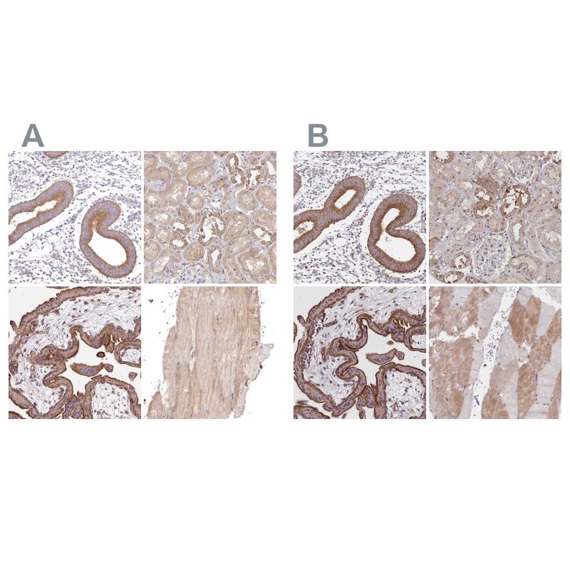 <b>Orthogonal Strategies Validation. </b>Staining of human endometrium, kidney, placenta and skeletal muscle HPA037686 (A) shows similar protein distribution across tissues to independent antibody HPA037685 (B).