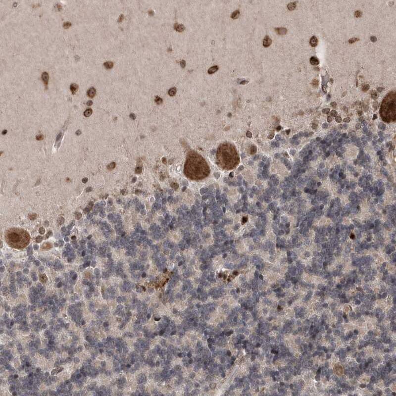 Immunohistochemistry-Paraffin ANKRD56 Antibody - BSA Free