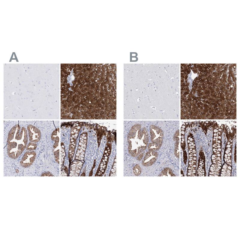 Staining of human cerebral cortex, liver, prostate and rectum HPA036656 (A) shows similar protein distribution across tissues to independent antibody HPA036657 (B).