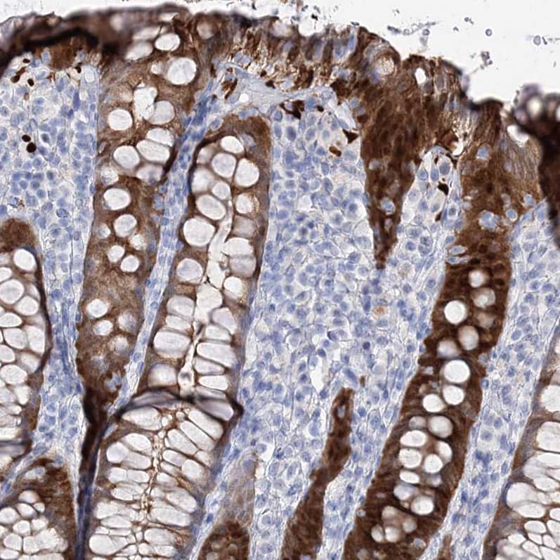 Staining of human rectum shows strong cytoplasmic positivity in glandular cells.