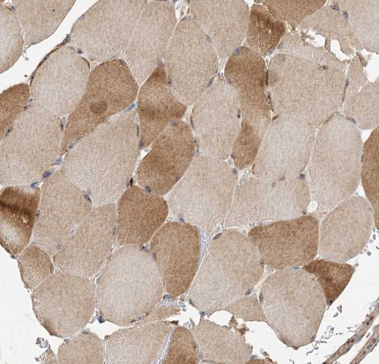 Staining of human skeletal muscle shows moderate cytoplasmic with additional nucleoli positivity in myocytes.