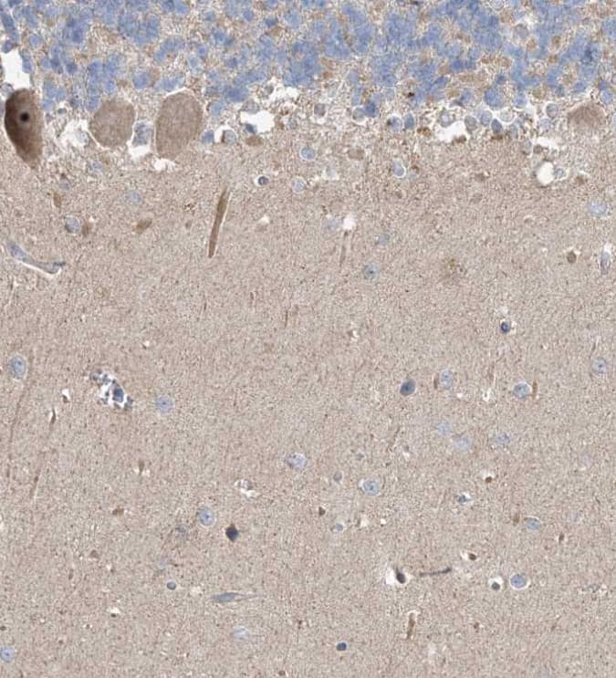 Staining of human cerebellum shows moderate cytoplasmic-nucleoli positivity in Purkinje cells.