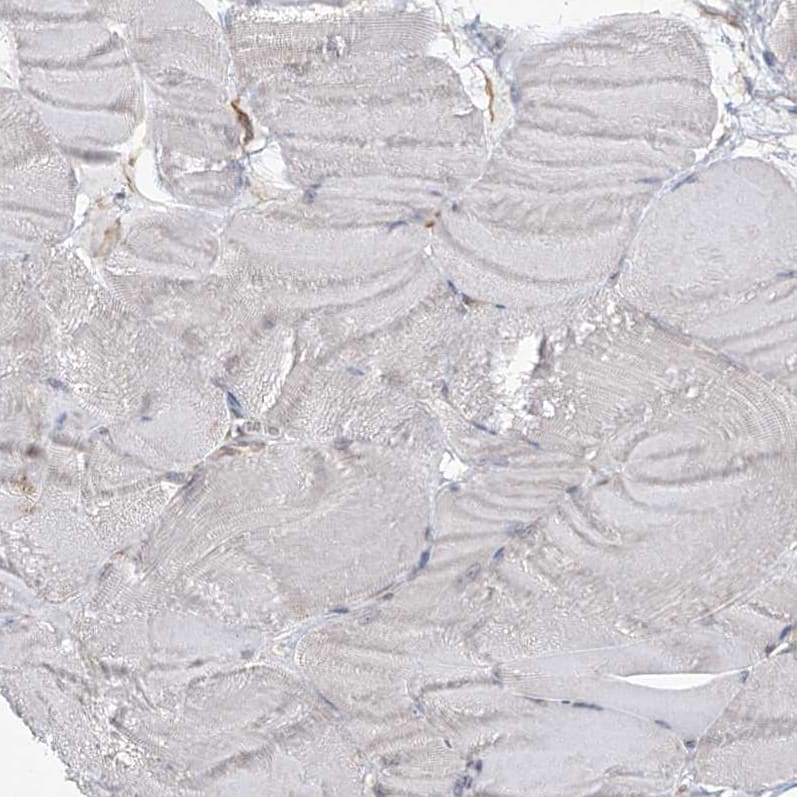 Staining of human skeletal muscle shows low expression in myocytes as expected.