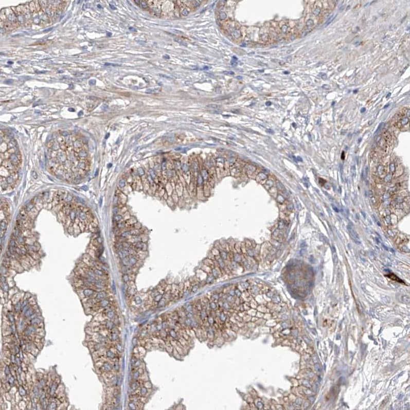 Staining of human prostate shows moderate membranous positivity in glandular cells.
