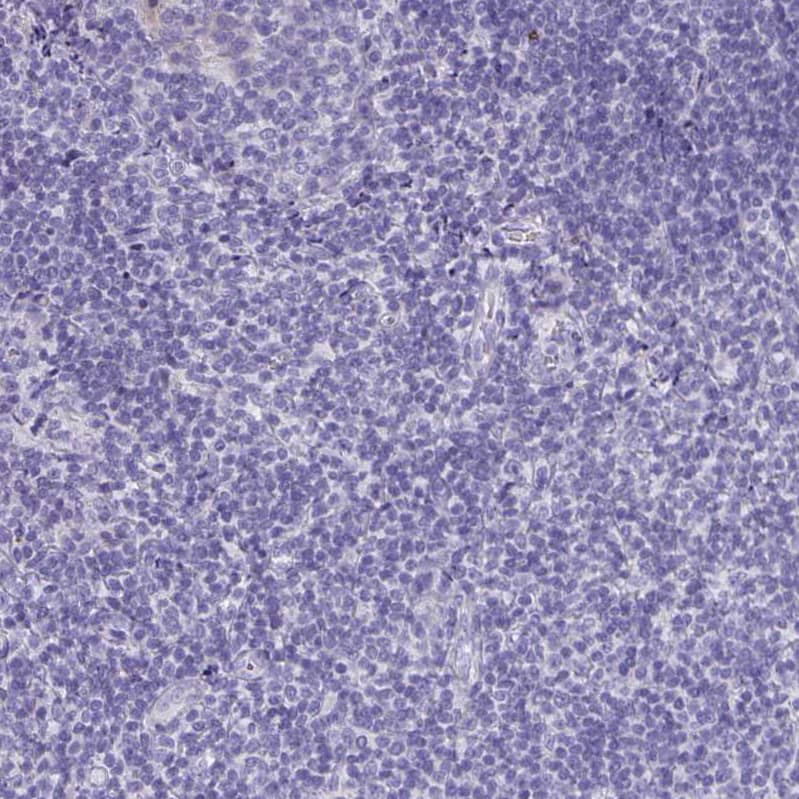 Staining of human tonsil shows negative membranous positivity in non-germinal center cells and germinal center cells as expected.