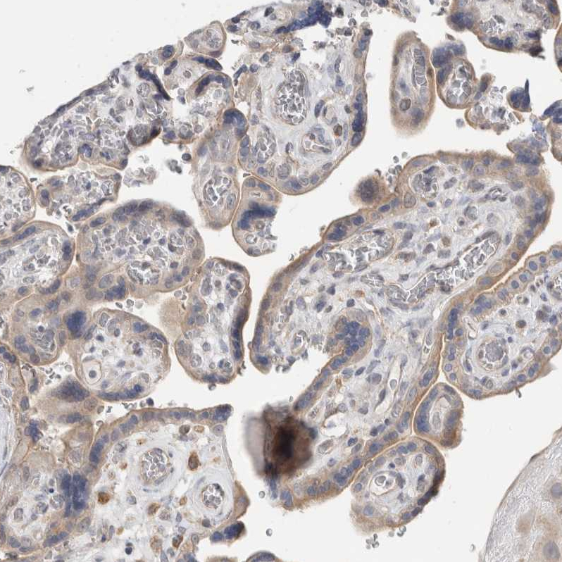 Staining of human placenta shows moderate membranous and cytoplasmic positivity in trophoblastic cells.