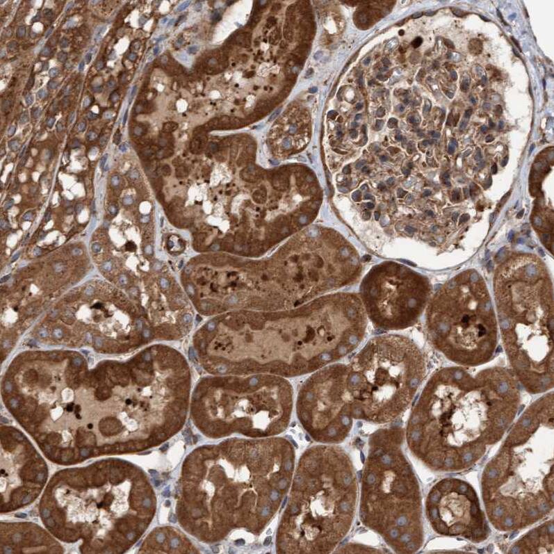 Immunohistochemistry-Paraffin KIAA0753/MNR Antibody - BSA Free