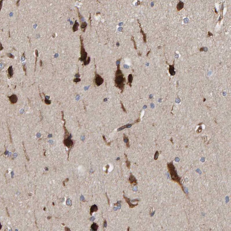 Immunohistochemistry-Paraffin KIAA0753/MNR Antibody - BSA Free
