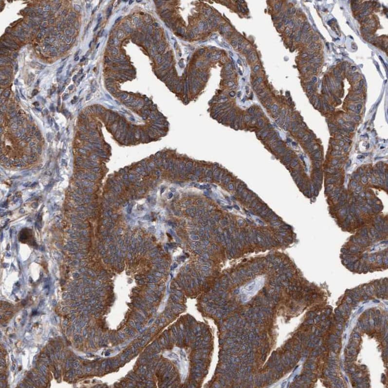 Immunohistochemistry-Paraffin KIAA0753/MNR Antibody - BSA Free