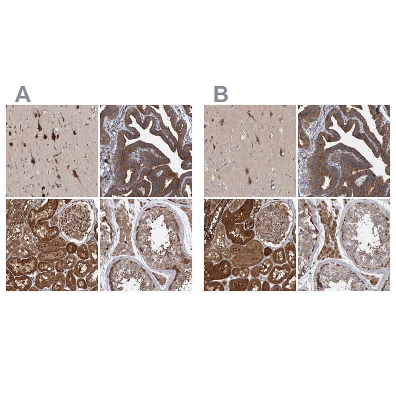 Immunohistochemistry-Paraffin KIAA0753/MNR Antibody - BSA Free
