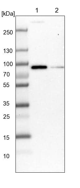 Lane 1: NIH-3T3 cell lysate (Mouse embryonic fibroblast cells)Lane 2: NBT-II cell lysate (Rat Wistar bladder tumour cells)