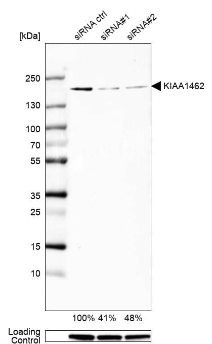 <b>Genetic Strategies Validation. </b>Analysis in U-138MG cells transfected with control siRNA, target specific siRNA probe #1 and #2. Remaining relative intensity is presented. Loading control: Anti-GAPDH.