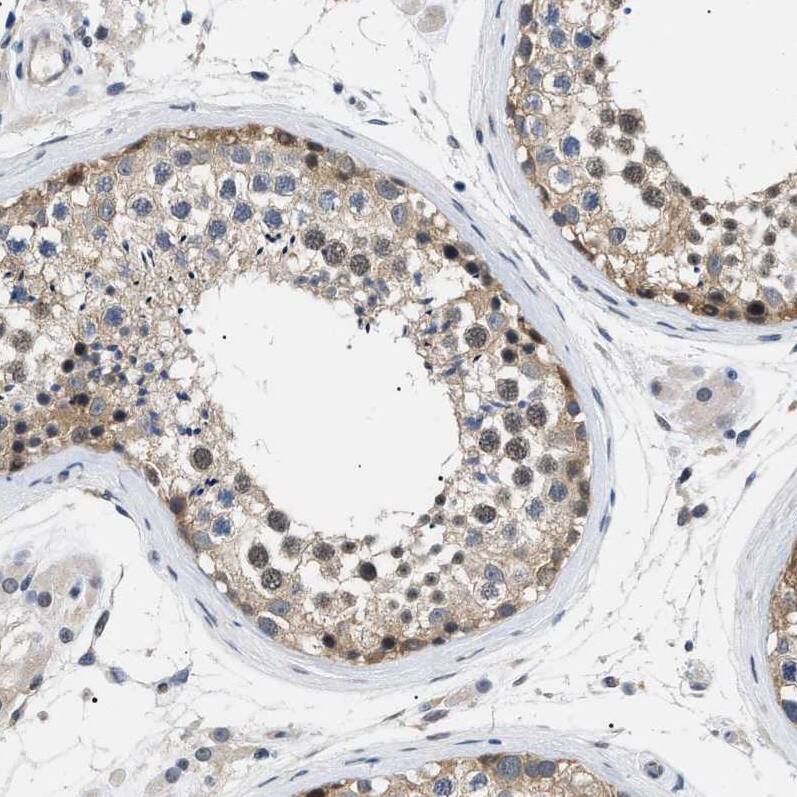 Immunohistochemistry-Paraffin KIAA0355 Antibody - BSA Free