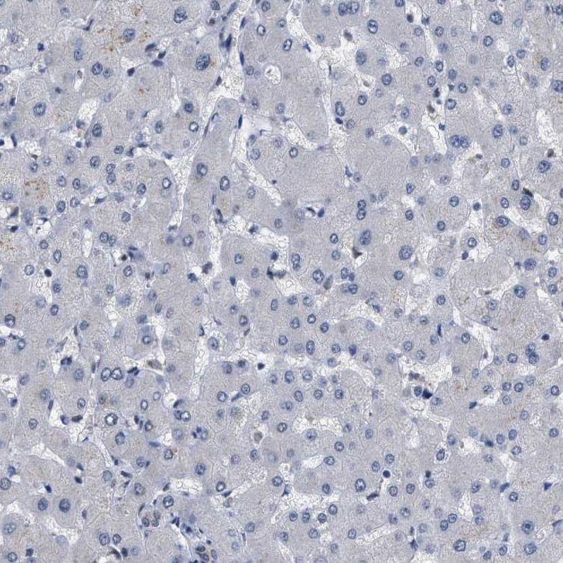 Immunohistochemistry-Paraffin KIAA0355 Antibody - BSA Free