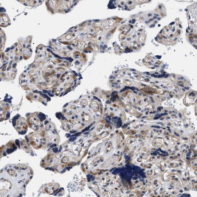 Immunohistochemistry-Paraffin KIAA0355 Antibody - BSA Free