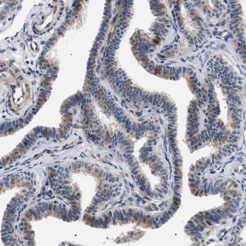 Immunohistochemistry-Paraffin KIAA0355 Antibody - BSA Free