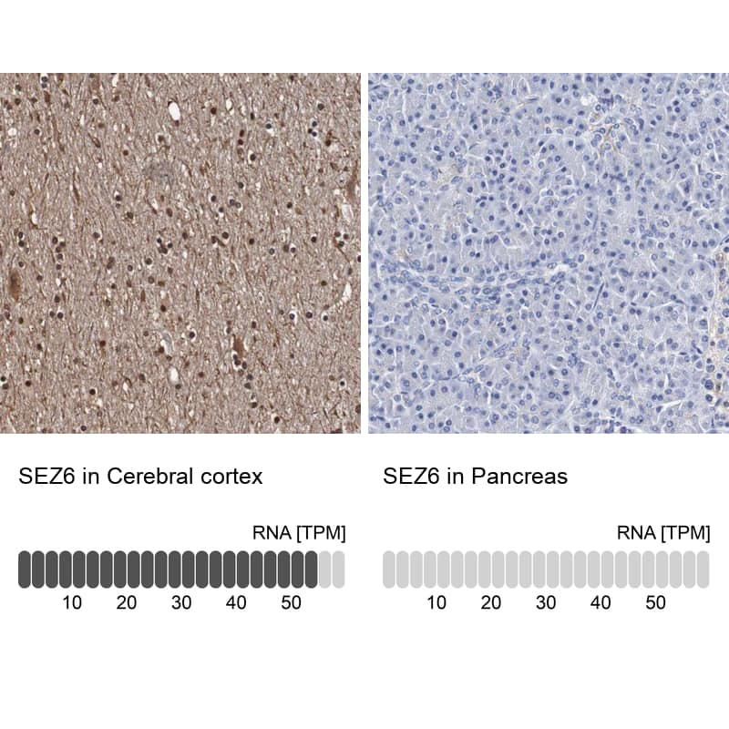 Immunohistochemistry SEZ6/BSRP-C Antibody - BSA Free