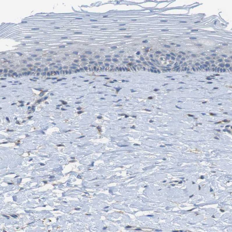 Staining of human cervix shows no positivity in squamous epithelial cells as expected.