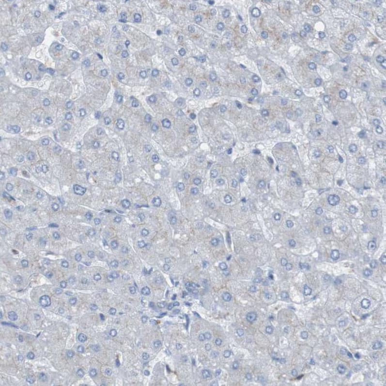 Staining of human liver shows no positivity in hepatocytes as expected.
