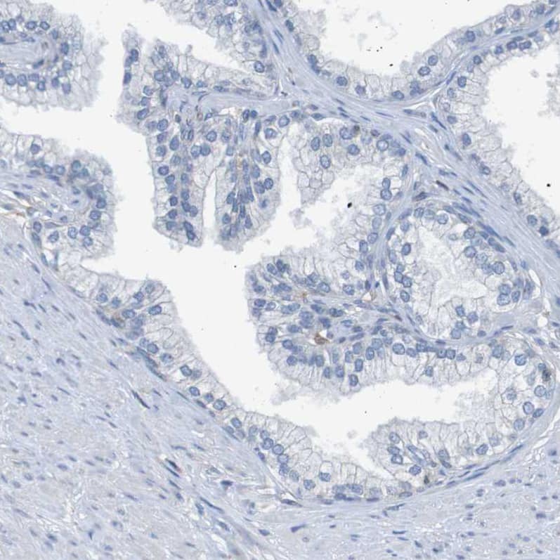 Staining of human prostate shows no positivity in glandular cells as expected.
