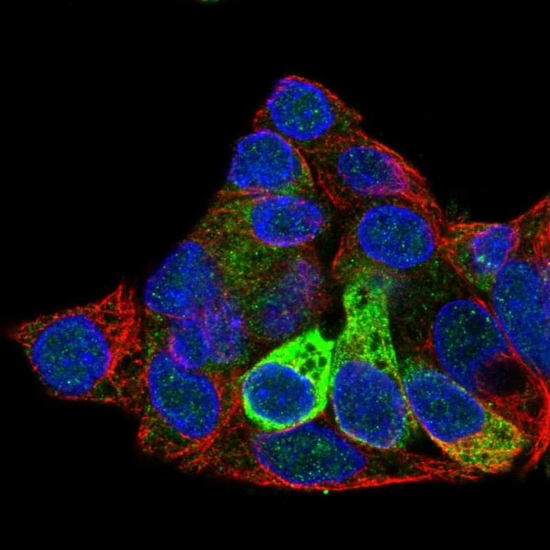 Staining of human cell line Hep G2 shows localization to endoplasmic reticulum.