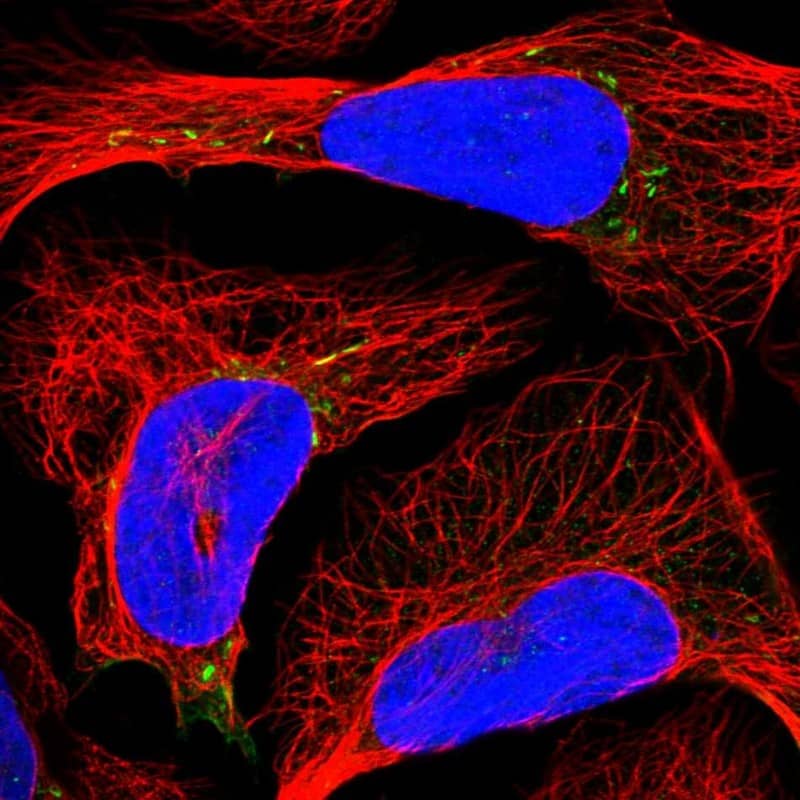 Staining of human cell line U-2 OS shows localization to vesicles.
